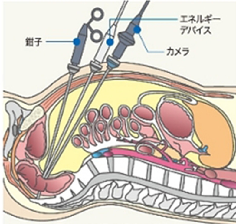 腹腔鏡手術について 総合大雄会病院 愛知県一宮市