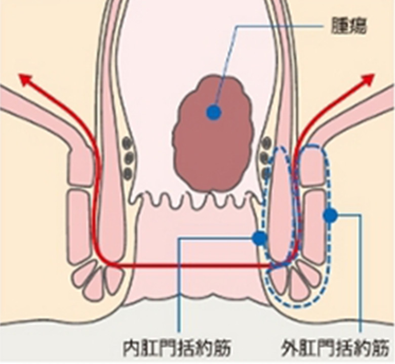 図4　直腸・肛門の拡大図