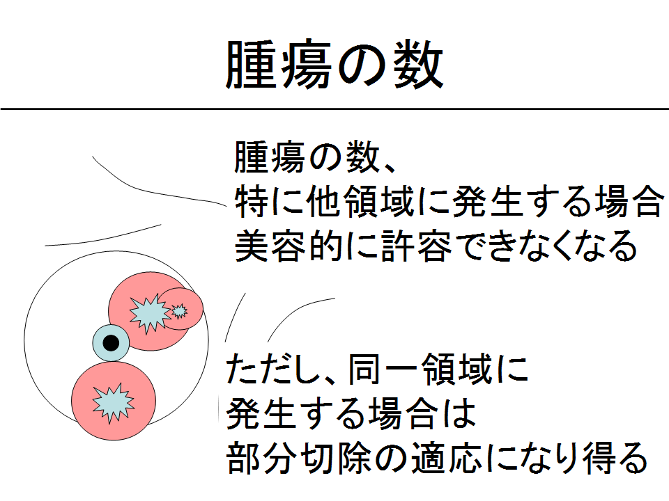 腫瘍の数