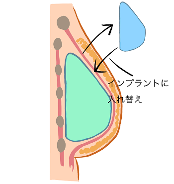 図4