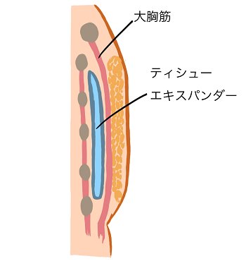 図2