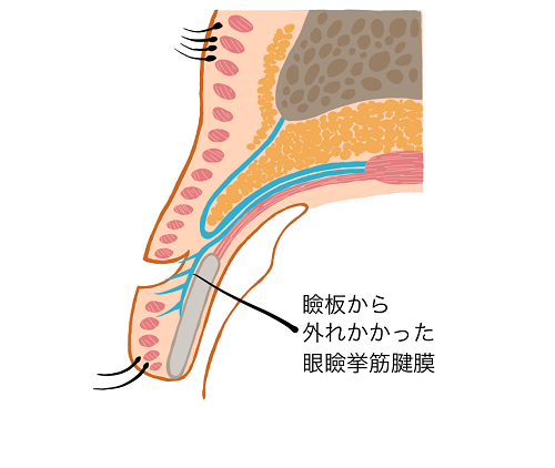 図2