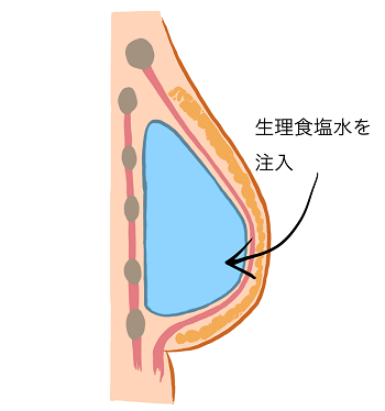 図3