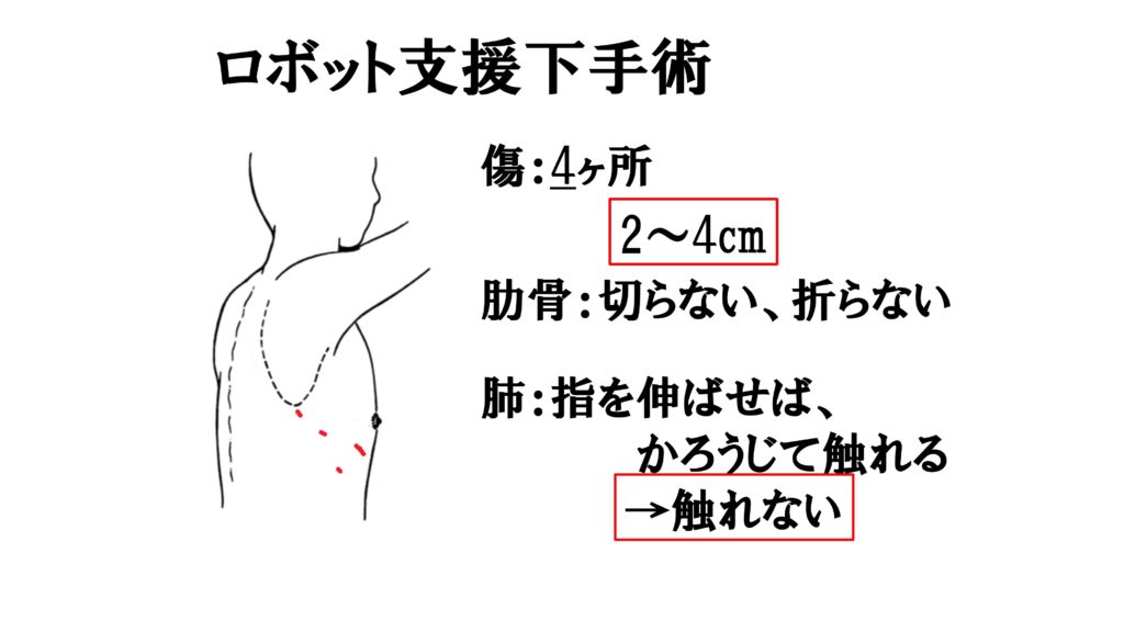 図16