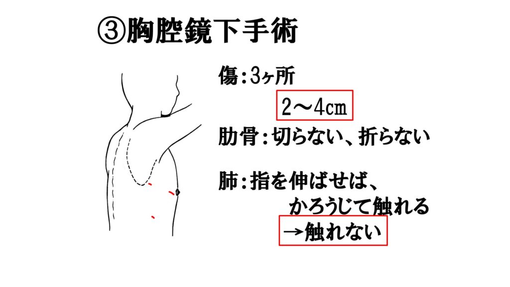 図11