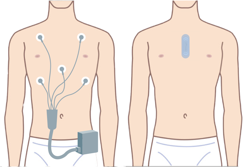 【左】従来のホルター心電計
【右】電極一体型ホルター心電計