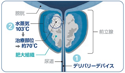 資料提供:ボストン・サイエンティフィック ジャパン株式会社