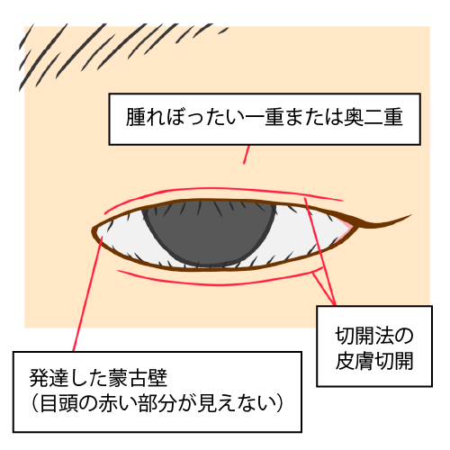 （図2）