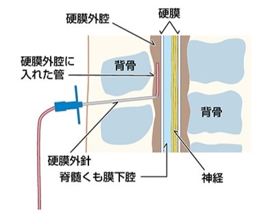 ©日本産科麻酔学会