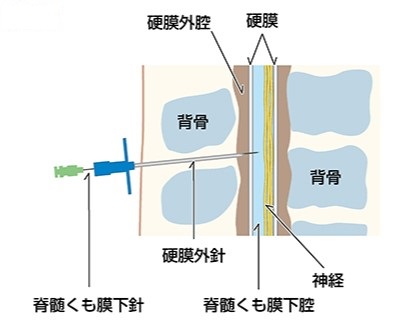 ©日本産科麻酔学会